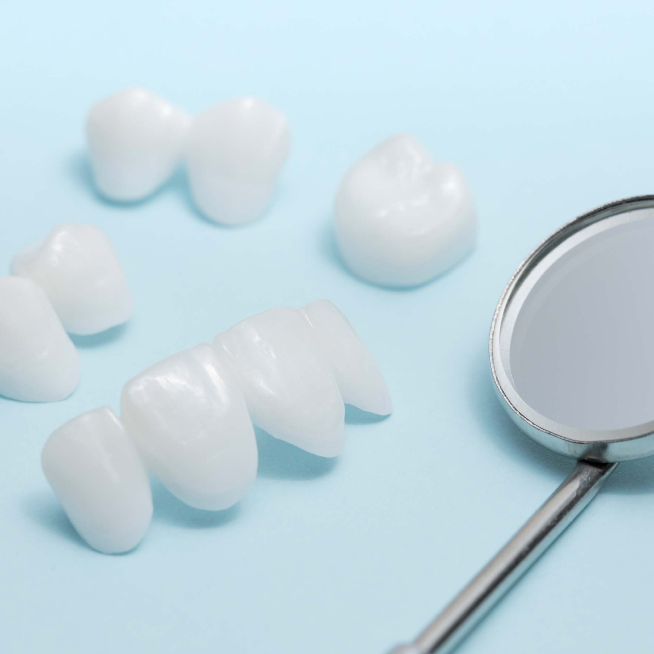 Mosolytervezés - porcelánhéjak